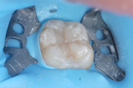 Aesthetic Dentistry Practice Opening Story 3 image 2