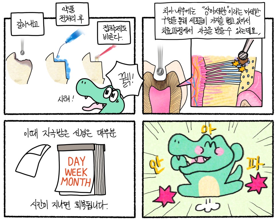 오래된 아말감 교체해야 할까요? 앞니 안쪽 충치 레진 수복 이야기 관련 이미지 4