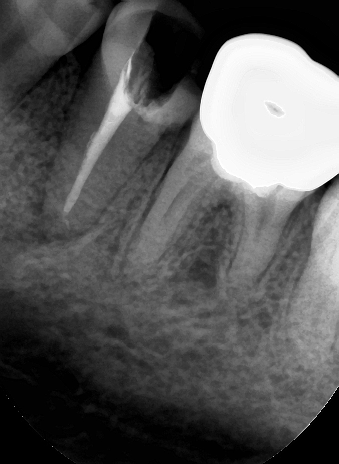치과 페이닥터 3개월째 근무 일기 long ver. 관련 이미지 6