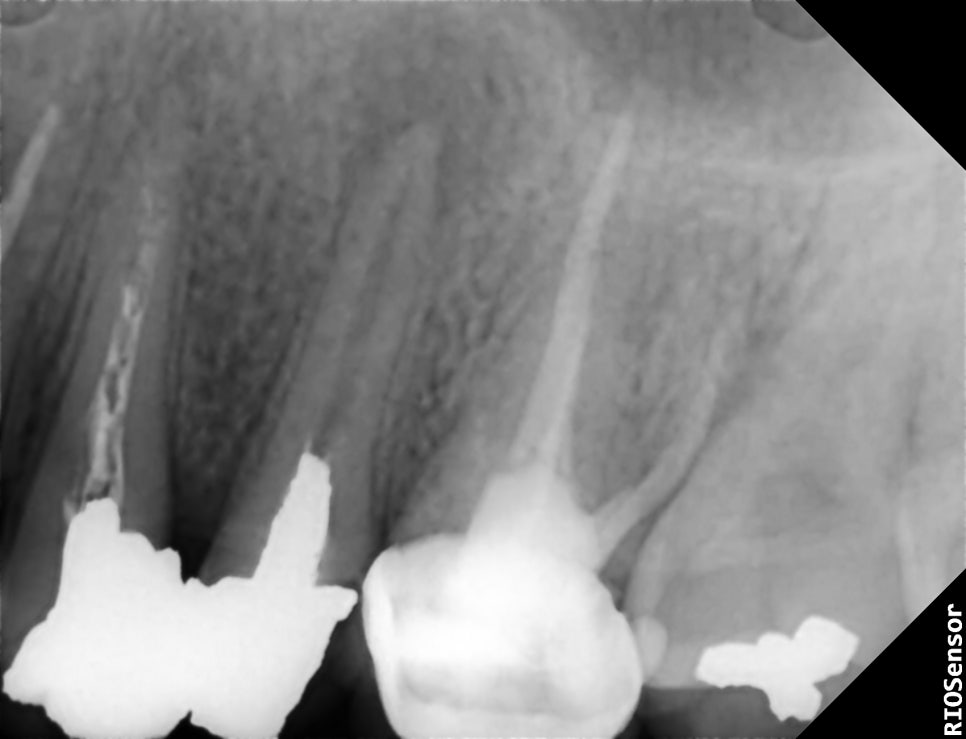 치과 공보의 일기 (9) : 교도소 치과 초빙(자비)진료 관련 이미지 1