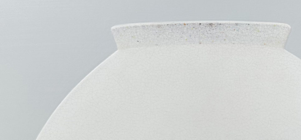 교대역 재주좋은치과 앞니 레진 비용이 저렴하지 않은 이유 관련 이미지 2