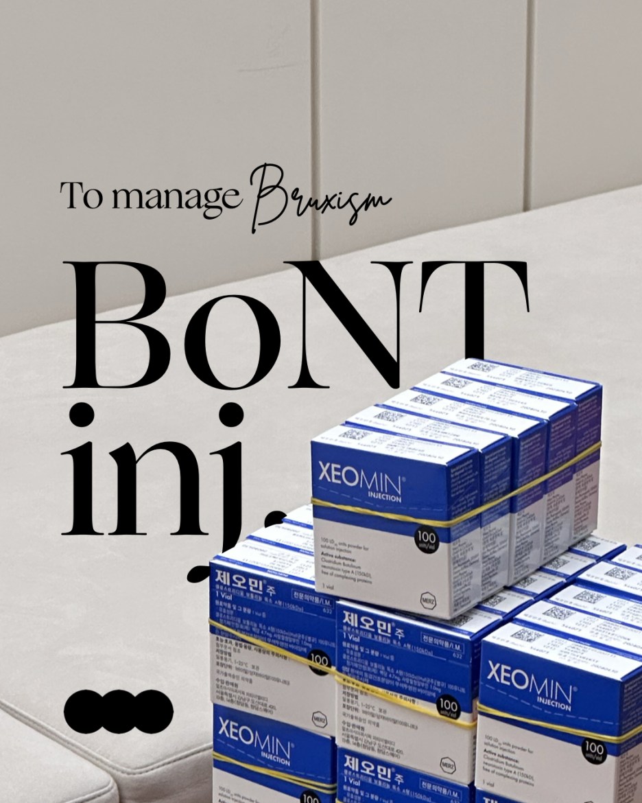 이갈이 장치 보톡스랑 함께 하면 훨씬 좋은 이유 관련 이미지 4