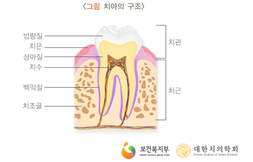 신논현치과 치아미백 누구나 예쁘게 하얗게 되는 건 아니다? 관련 이미지 4