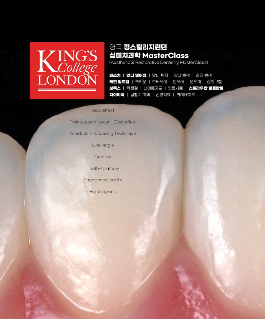 앞니 깨짐 레진 어디서할지 고민될 때 꼭 보세요 관련 이미지 4