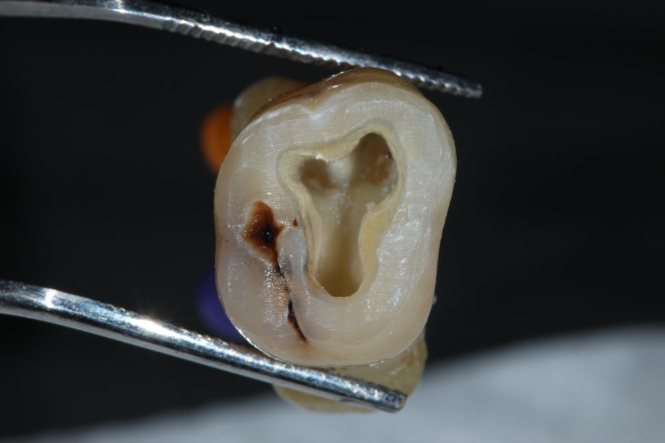 22년5월22일 / Troubleshooting Symposium, 조용식원장님 AO intensive course 관련 이미지 4