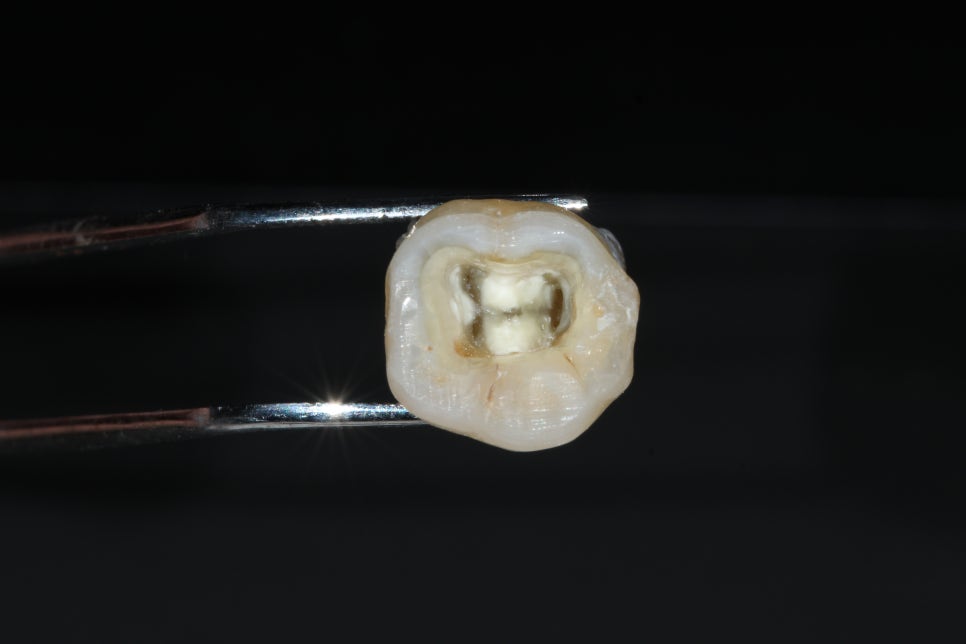 22년5월22일 / Troubleshooting Symposium, 조용식원장님 AO intensive course 관련 이미지 6