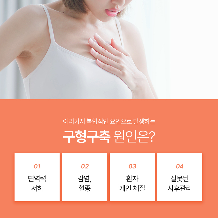 가슴성형절개부위, 구형구축이 생겼다면? 관련 이미지 3