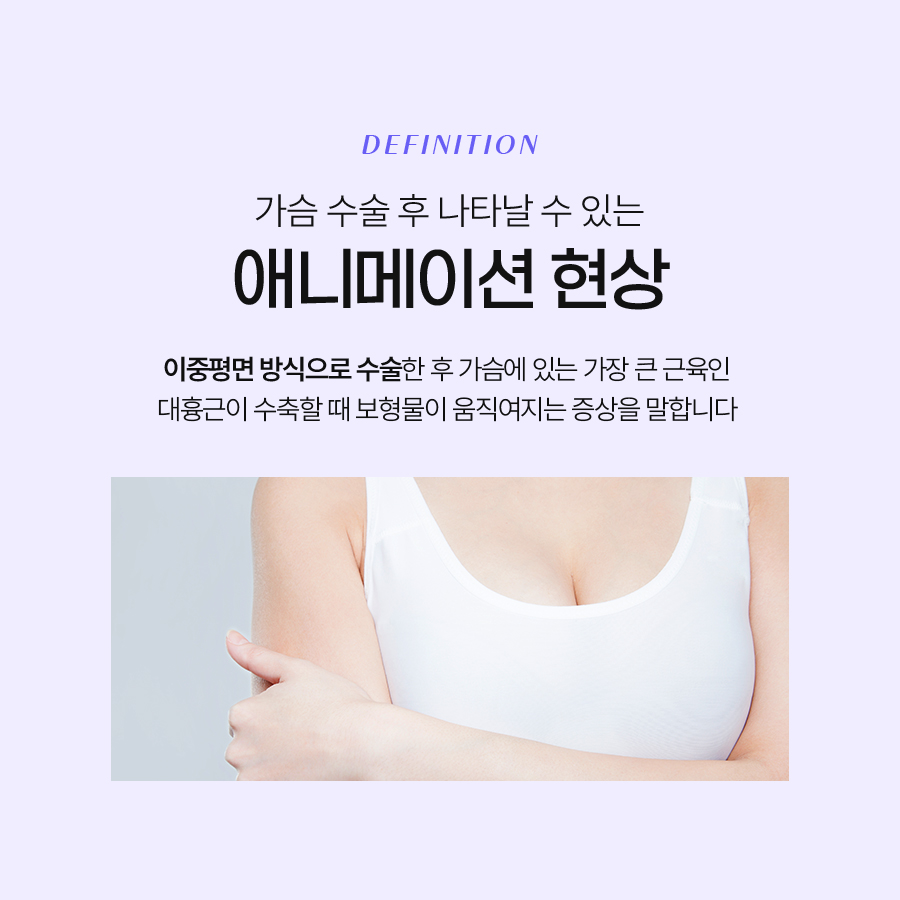 애니메이션 현상 고민이라면? 삼중평면법으로 교정하기 관련 이미지 3