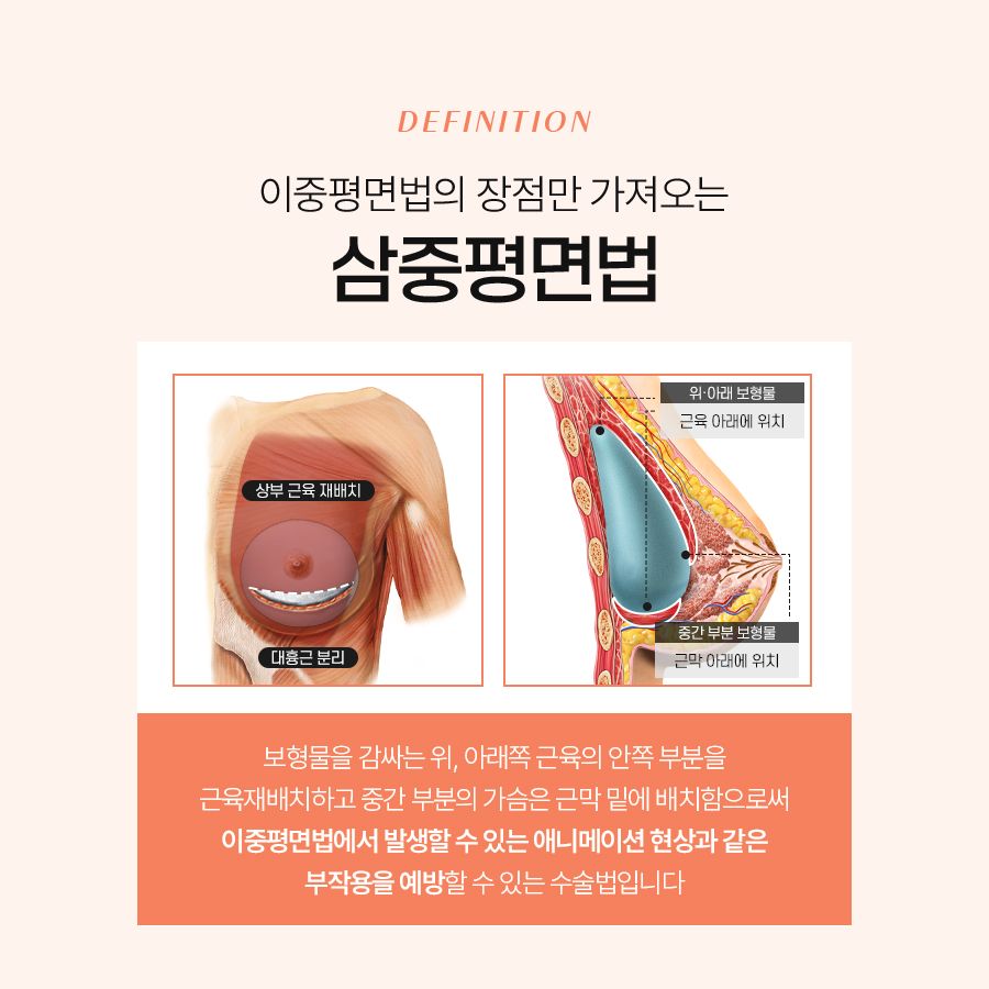 가슴확대성형수술 실루엣을 완성하는 섬세한 선택 관련 이미지 6