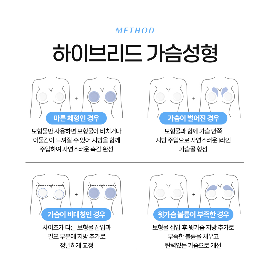 하이브리드가슴수술 촉감부터 라인까지 완벽 개선 관련 이미지 5