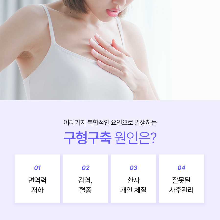 가슴재수술겨절 기존 수술과 다른 점은 관련 이미지 3