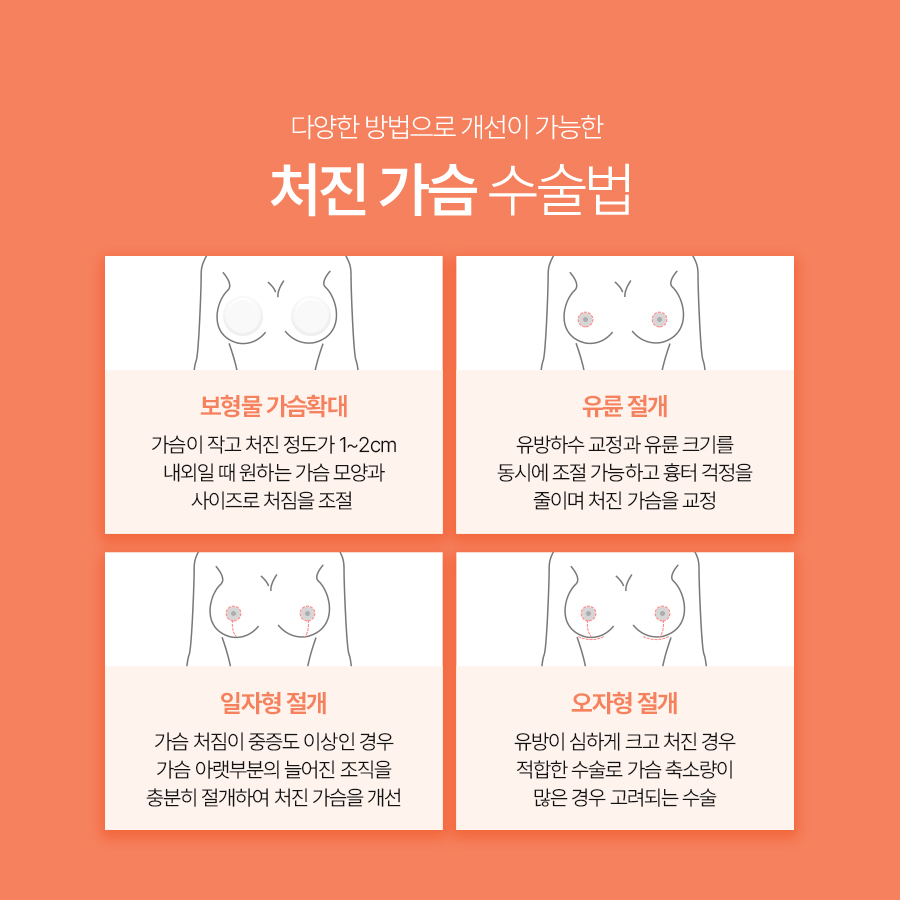 유방하수교정수술, 보형물만으로 해결되지 않는 가슴 처짐 관련 이미지 6