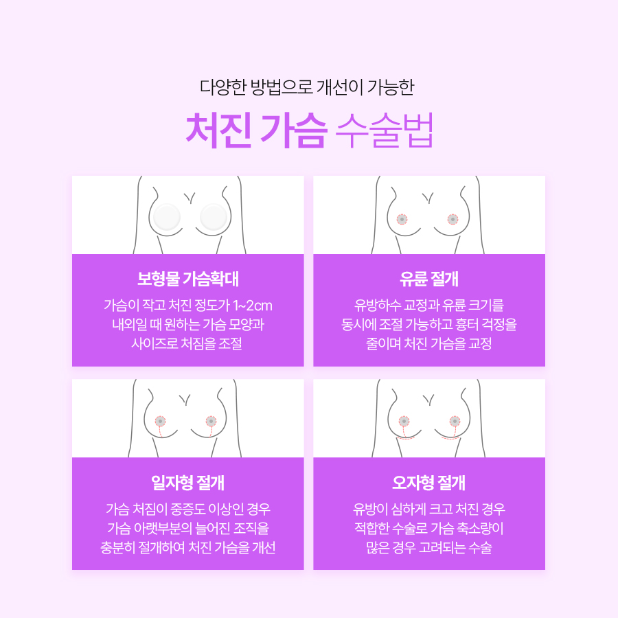 중년가슴성형 처진 가슴 개선으로 되찾는 상체 라인 관련 이미지 6