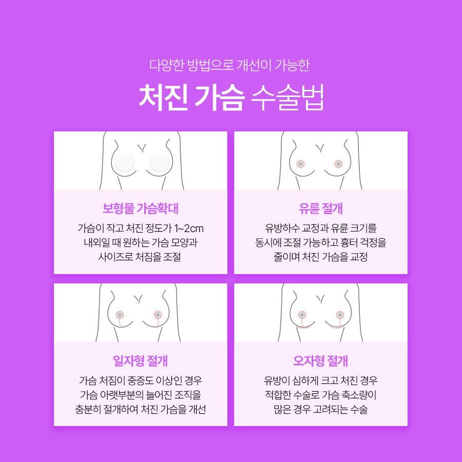 유방하수수술 병원, 처진 가슴 수술 전 확인해야 할 점 관련 이미지 6