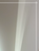 처진가슴교정술 가슴 탄력 개선을 위한 방법 관련 이미지 21