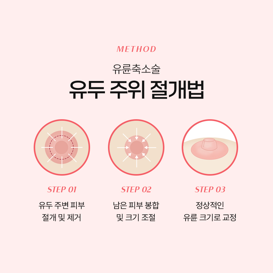 가슴유륜축소술 가슴 비율에 맞는 크기를 원한다면 관련 이미지 4