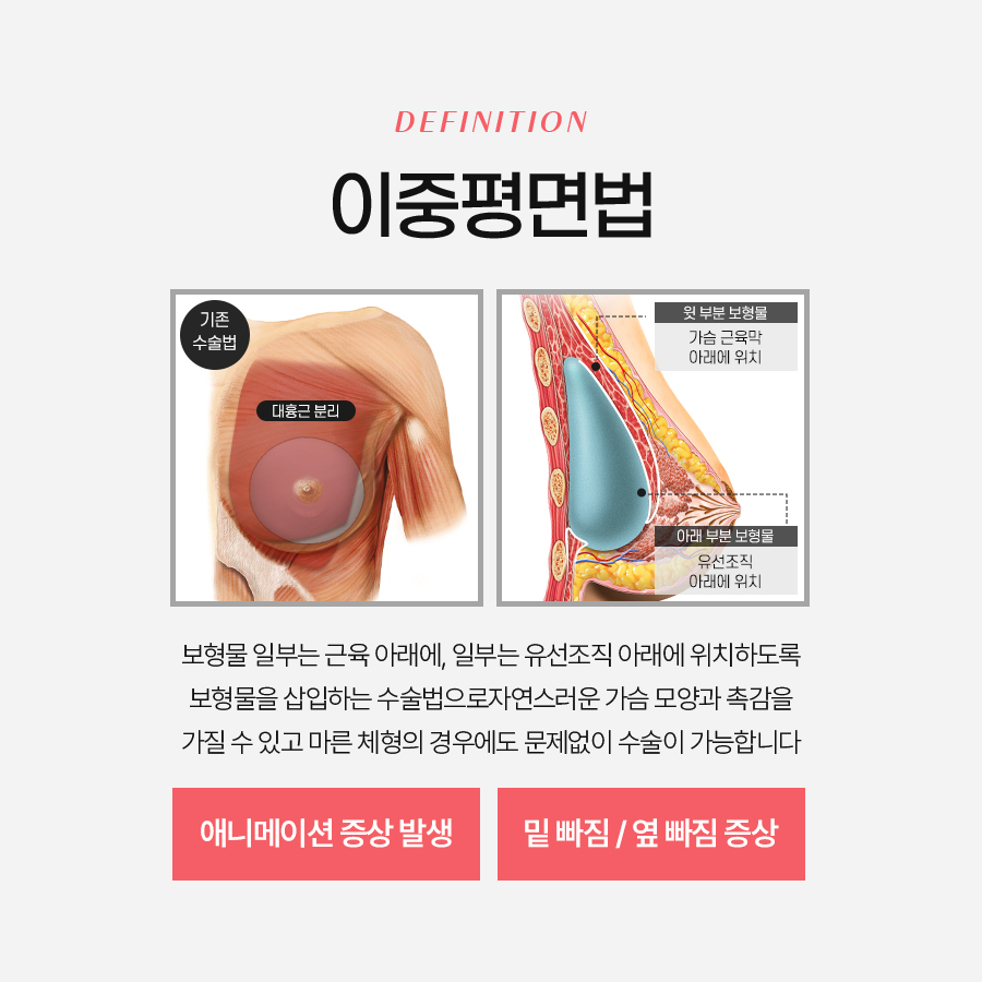애니메이션 현상 왜 생기고 어떻게 개선할까? 관련 이미지 4