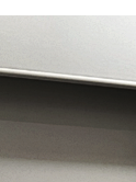 What Determines the Results of Breast Augmentation for a Flat Chest and Natural-Looking Volume? image 19
