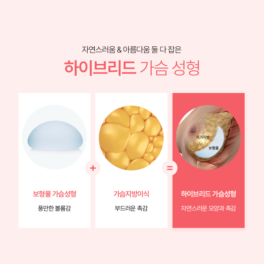하이브리드가슴성형, 나에게 맞는 사이즈로 자연스럽게 관련 이미지 4
