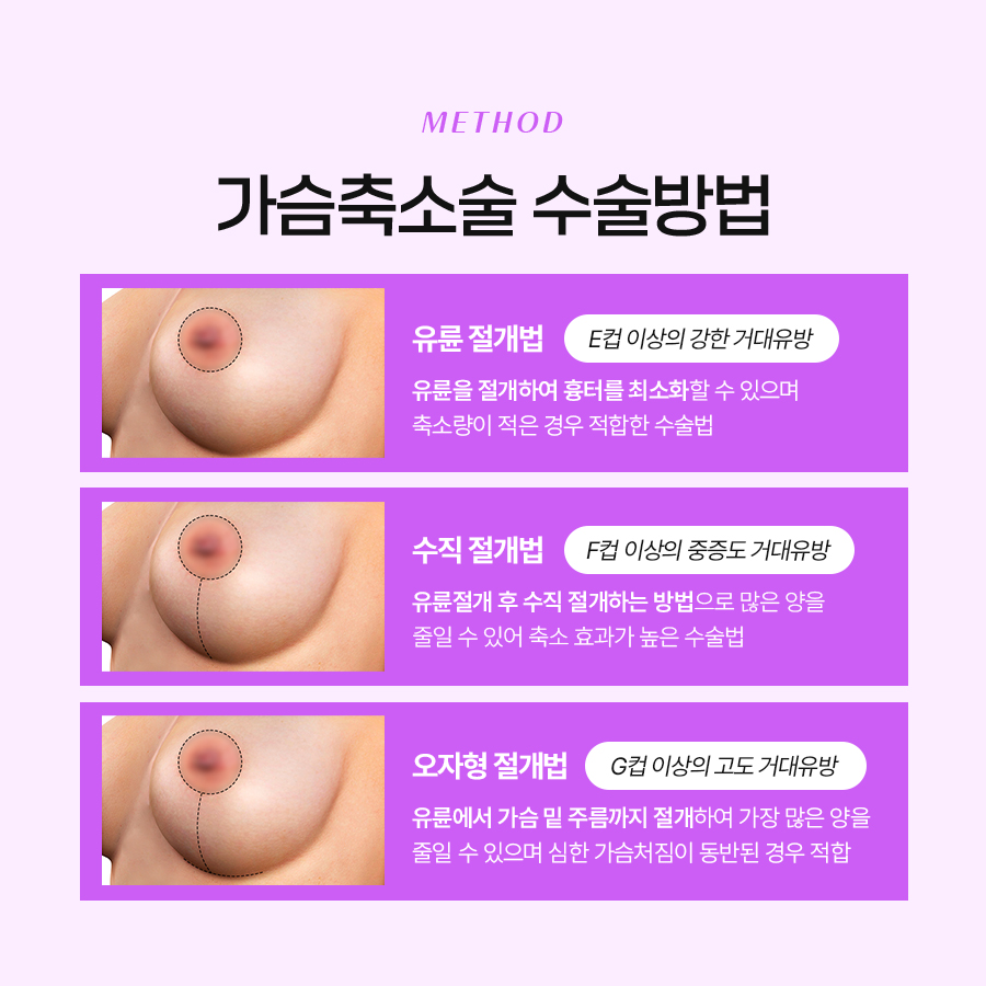 Breast Reduction Surgery: A Choice That Improves Quality of Life, Not Just a Simple Procedure image 5