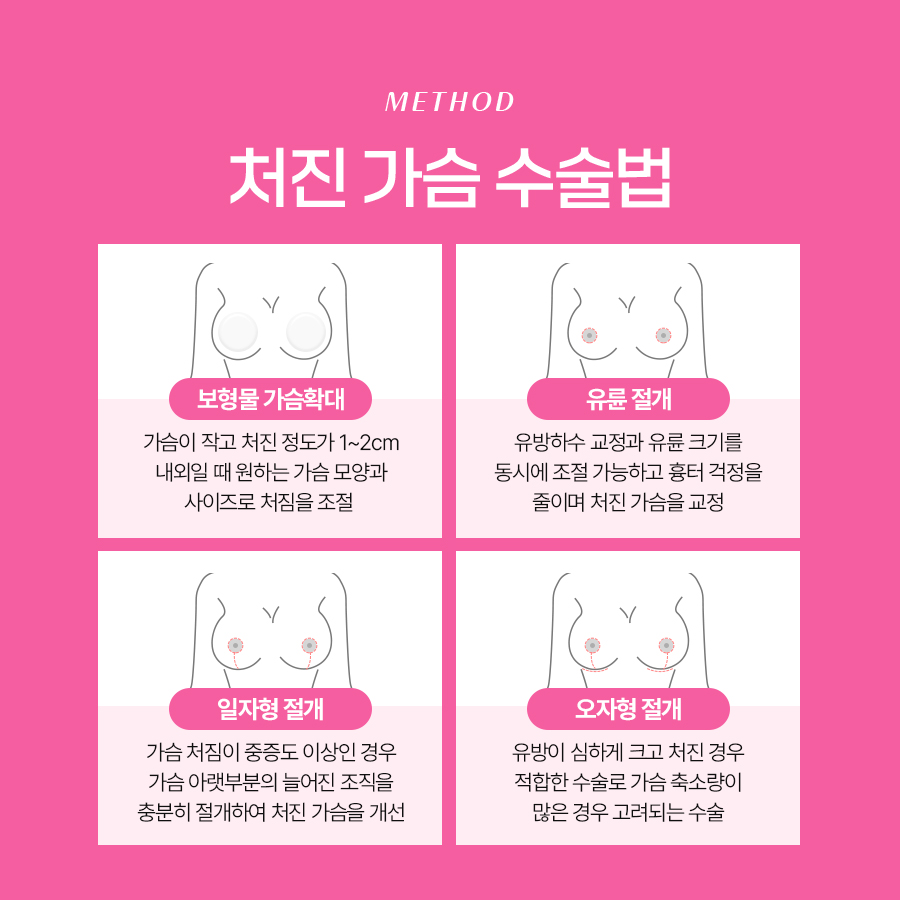 처진가슴수술비용 처짐 정도에 따라 달라지는 교정 방법 관련 이미지 6