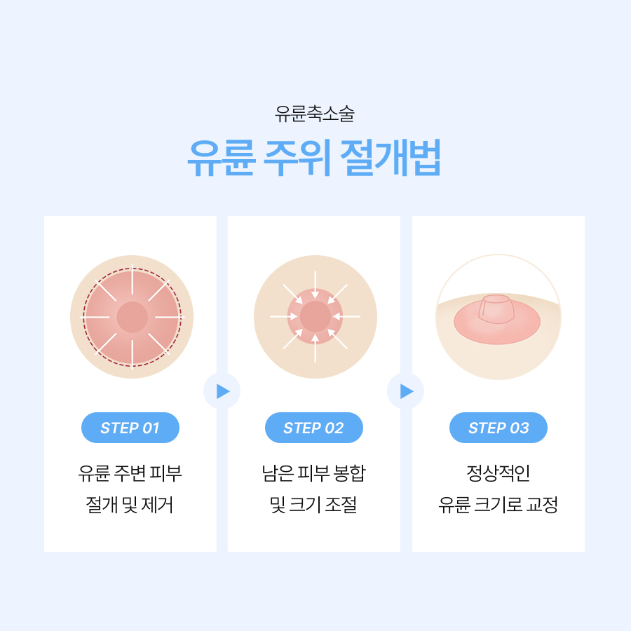 Why Areola Size Correction Should Consider Breast Proportions image 5