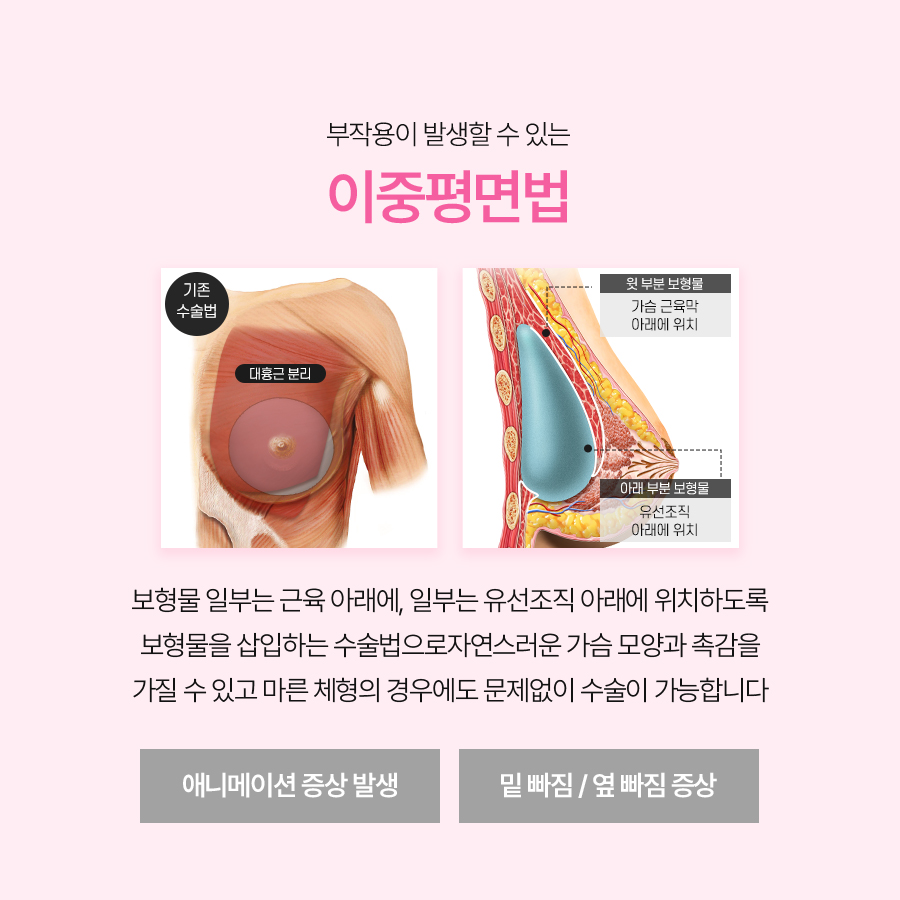 Recommended Breast Revision Surgery Clinics: Why the Triple-Plane Technique Is Drawing Attention image 3