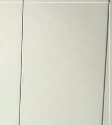 Mentor Boost Breast Augmentation: Preserving Volume While Providing a Softer Feel image 21