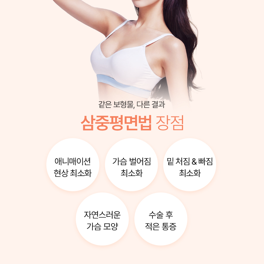 가슴재수술방법 삼중평면으로 달라지는 결과 관련 이미지 5
