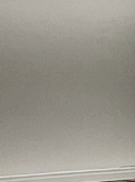 What Determines the Results of Breast Augmentation for a Flat Chest and Natural-Looking Volume? image 22