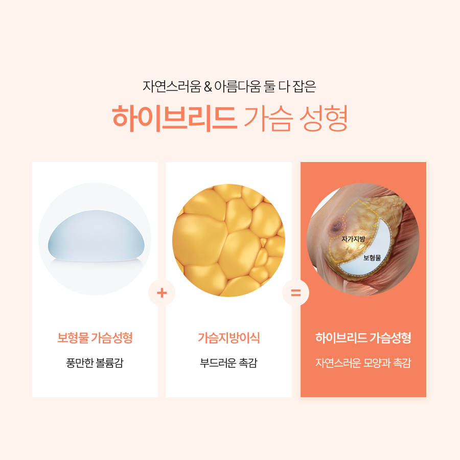 Breast Augmentation with Fat Grafting in Detail: Achieving Upper Breast Volume and a Natural Feel at the Same Time image 4