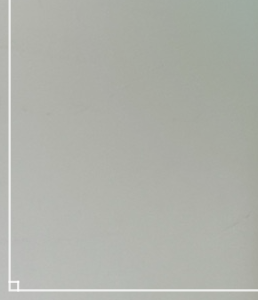 Breast Augmentation with Fat Grafting in Detail: Achieving Upper Breast Volume and a Natural Feel at the Same Time image 16