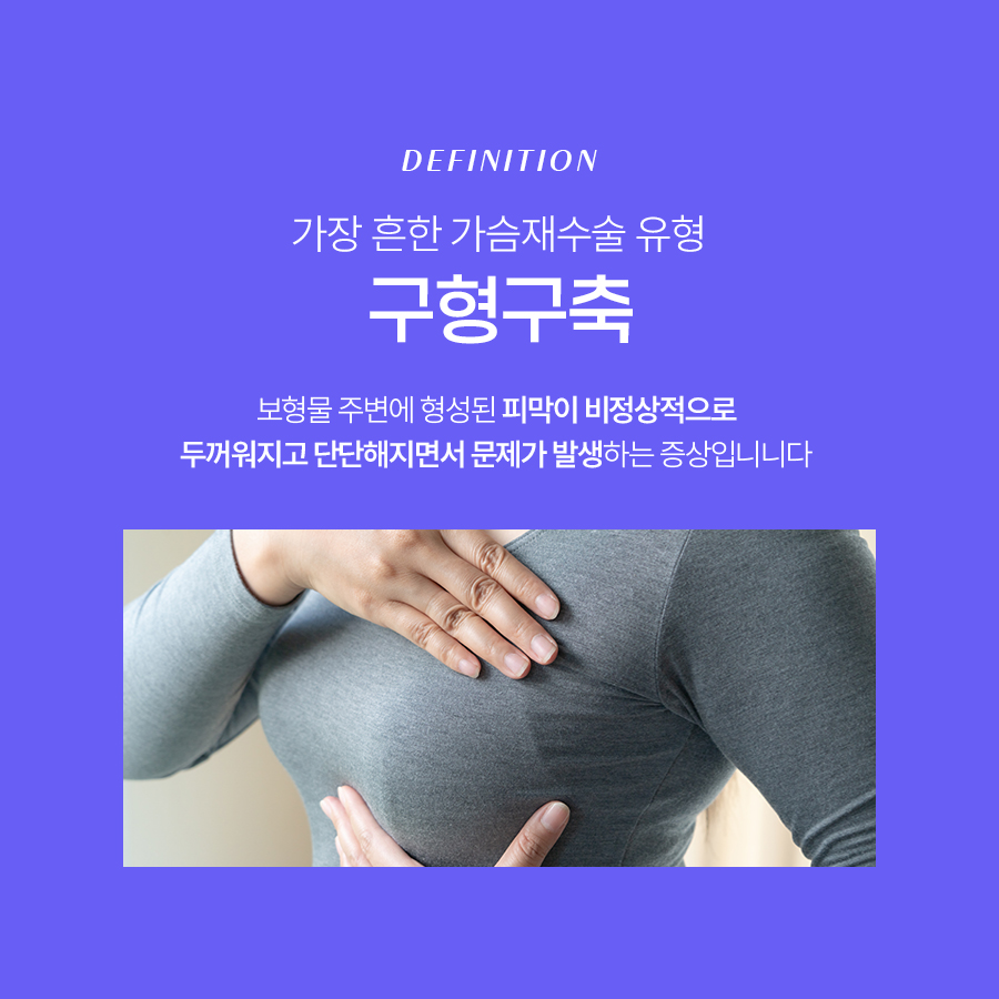 구형구축피막제거 가슴 재수술 성공하기 위한 조건 관련 이미지 3