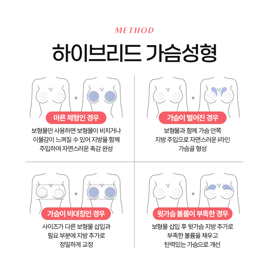 지방이식가슴수술 하이브리드 방식이 주목받는 이유는? 관련 이미지 6