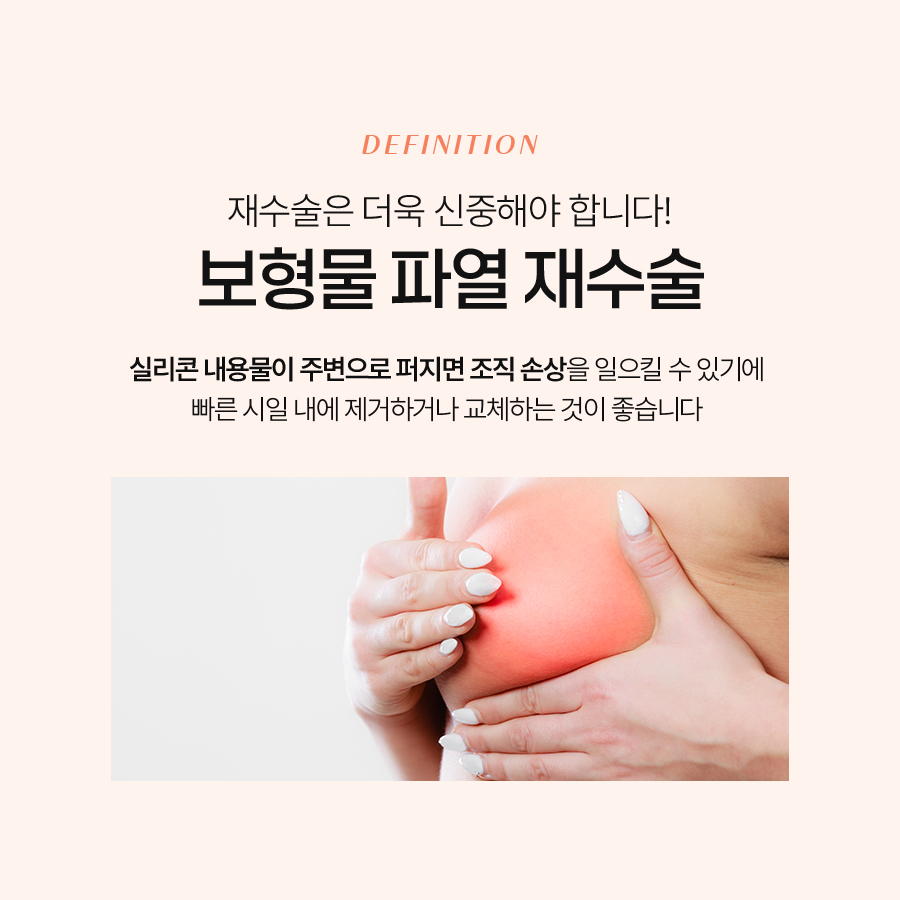 가슴겨절재수술 흉터 걱정 없는 두 번째 선택의 핵심 관련 이미지 3