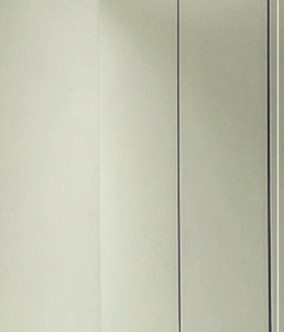 Mentor Boost Breast Augmentation: Preserving Volume While Providing a Softer Feel image 15