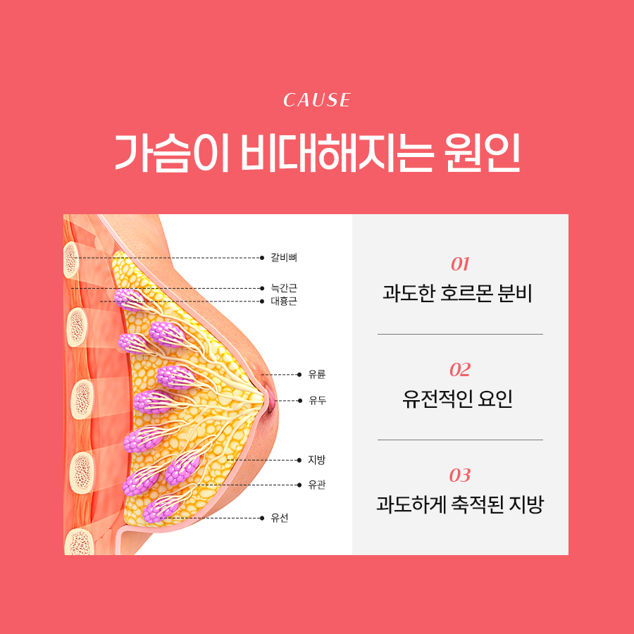 가슴축소성형수술 어떤 기준으로 계획될까? 관련 이미지 3