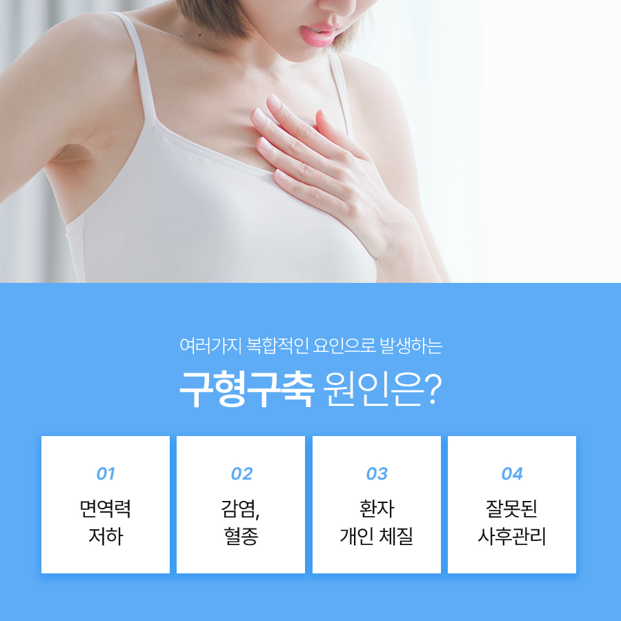 가슴구형구축원인부터 증상, 재수술 판단 기준까지 관련 이미지 3