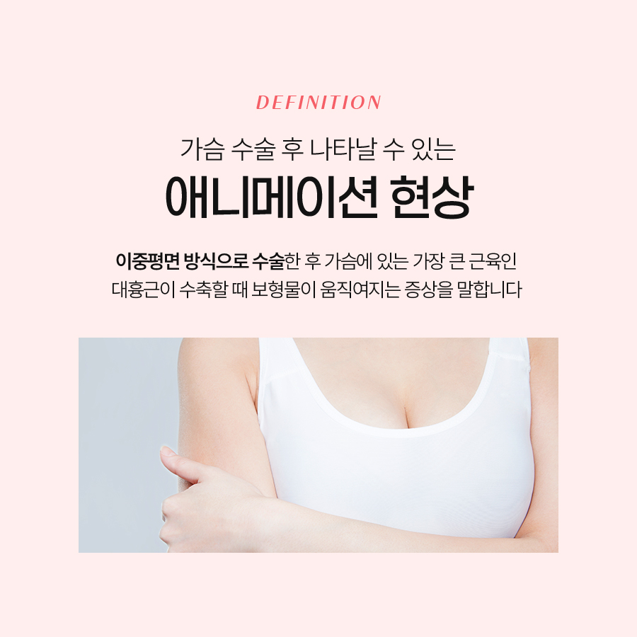 애니메이션 현상 왜 생기고 어떻게 개선할까? 관련 이미지 3