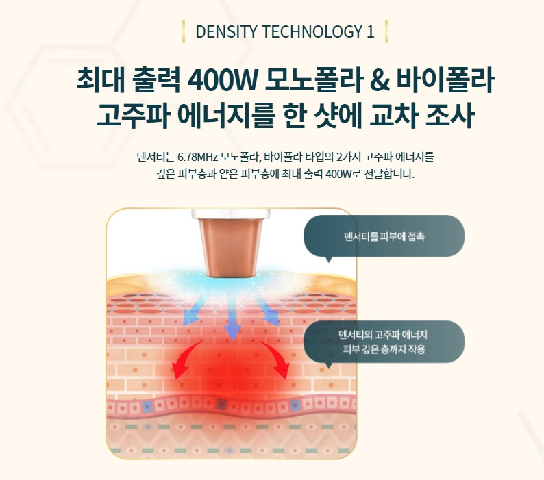 덴서티리프팅 팔자주름시술 효과를 경험하려면 관련 이미지 3
