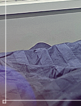 Accessory Breast Fat Removal: A Look at Accessory Breast Correction Considering Upper-Body Proportions image 25