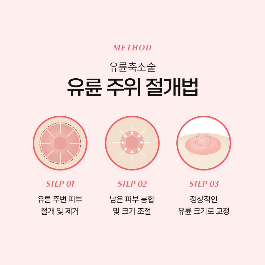 가슴유륜축소술 가슴 비율에 맞는 크기를 원한다면 관련 이미지 5