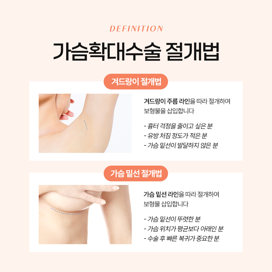 가슴성형수술병원 추천 나에게 맞는 가슴성형 선택법 관련 이미지 6