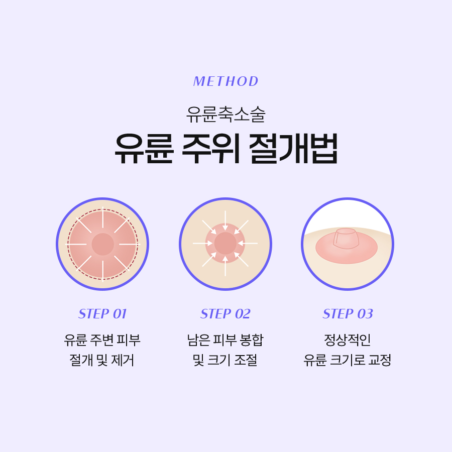 가슴유륜축소술 수술 후 기대할 수 있는 변화 관련 이미지 5