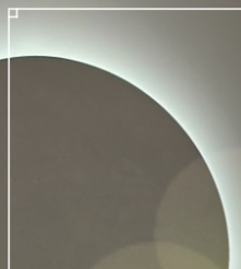 Hybrid Breast Surgery Seen from the Perspective of Fat Grafting Breast Augmentation image 10