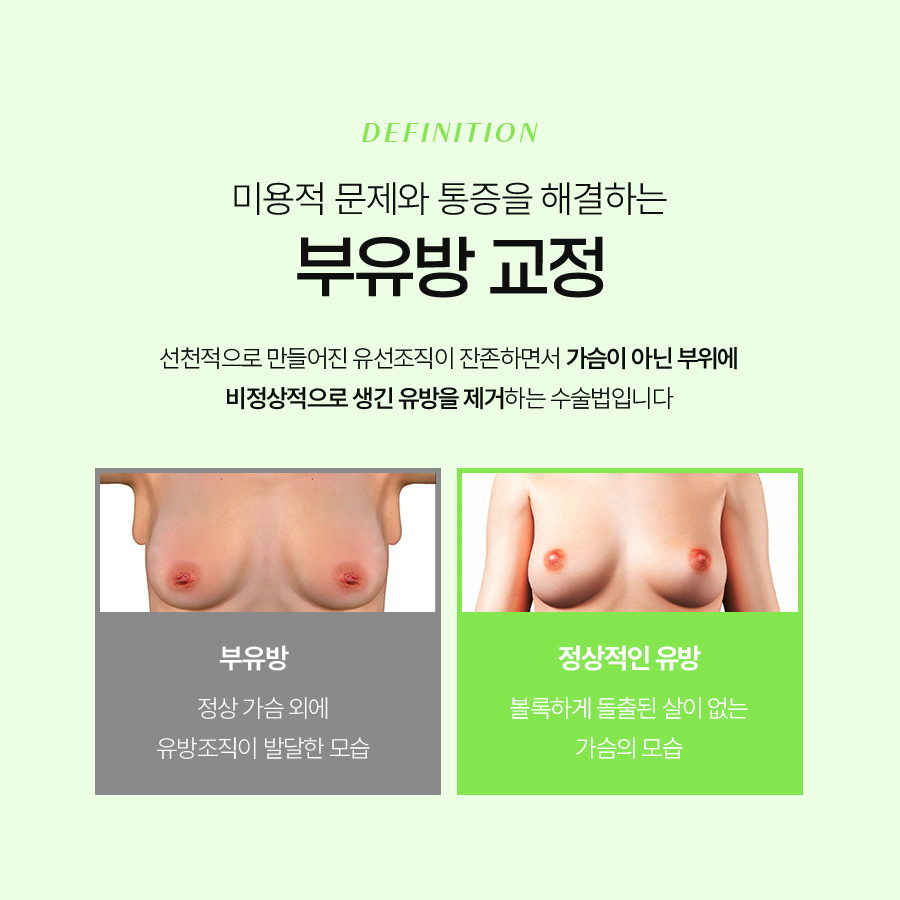 Accessory Breast Fat Removal: A Look at Accessory Breast Correction Considering Upper-Body Proportions image 4