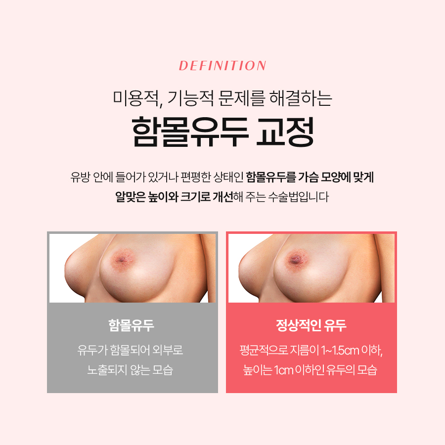 함몰유두교정방법 기능과 미용을 동시에 개선하는 솔루션 관련 이미지 3
