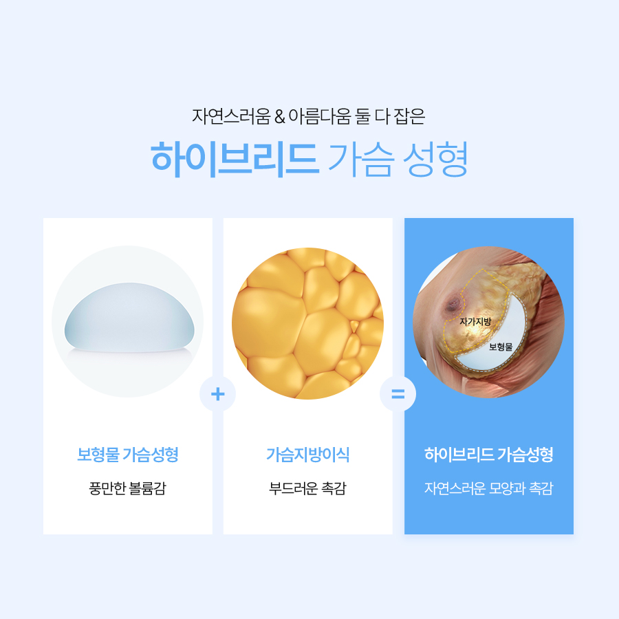 하이브리드가슴수술 자연스러움의 비결 관련 이미지 4