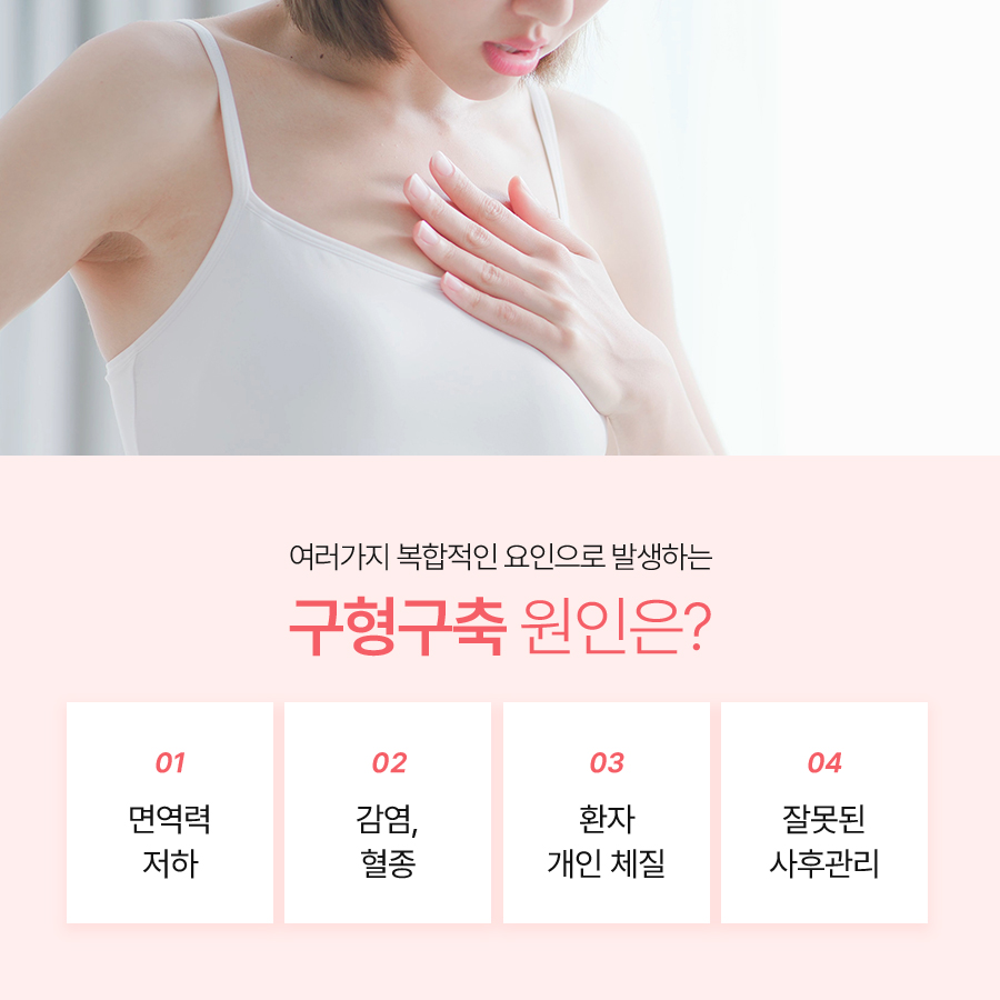 가슴구형구축 원인 알아야 재수술도 안전하다 관련 이미지 5