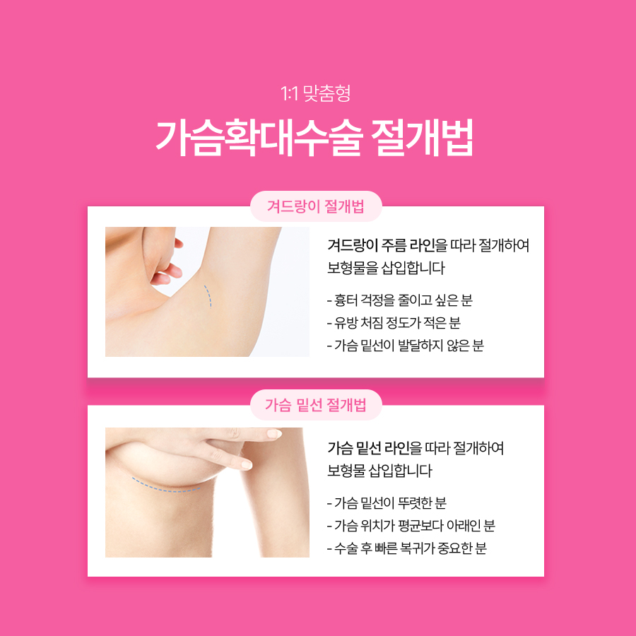 가슴재수술방법, 삼중평면법은 어떤 경우에 고려할까요? 관련 이미지 6